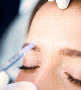 Toxina botulínica / Botox