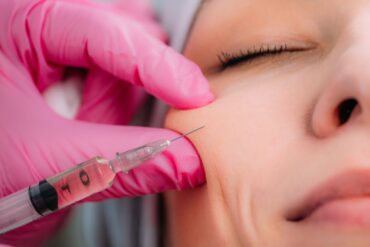 Toxina Botulínica / Botox